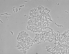 Schnelle Identifizierung von thermophilen Campylobacter-Arten